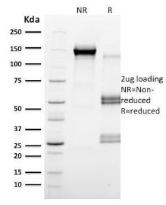 Anti-CD79b Mouse Monoclonal Antibody [clone: IGB/2555]