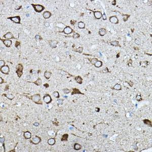 Immunohistochemistry analysis of paraffin-embedded rat brain using Anti-Strumpellin Antibody (A308848) at a dilution of 1:100 (40x lens). Perform high pressure antigen retrieval with 10 mM citrate buffer pH 6.0 before commencing with IHC staining protocol.