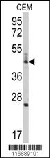 Anti-BCL2L13 Rabbit Polyclonal Antibody