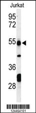 Anti-PDK4 Rabbit Polyclonal Antibody