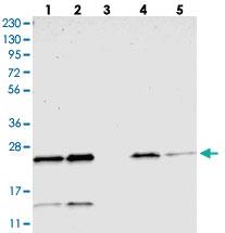 Anti-CCDC90B Rabbit Polyclonal Antibody