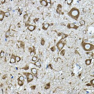 Immunohistochemistry analysis of paraffin-embedded mouse spinal cord using Anti-Strumpellin Antibody (A308848) at a dilution of 1:100 (40x lens). Perform high pressure antigen retrieval with 10 mM citrate buffer pH 6.0 before commencing with IHC staining protocol.