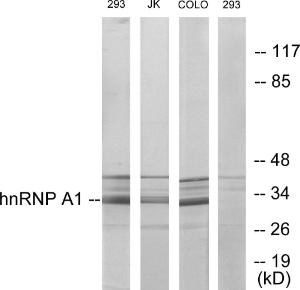 Western blot analysis of lysates from 293, Jurkat, and COLO205 cells using Anti-hnRNP A1 Antibody. The right hand lane represents a negative control, where the antibody is blocked by the immunising peptide