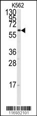 Anti-NDUFA13 Rabbit Polyclonal Antibody