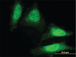 Anti-DAZ1 Mouse Monoclonal Antibody [clone: 3G10]