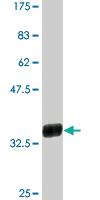 Anti-CXCL5 Mouse Monoclonal Antibody [clone: 2A9]