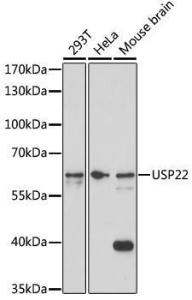 Western blot analysis of extracts of various cell lines, using Anti-USP22 Antibody (A308849) at 1:1,000 dilution