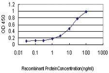 Anti-DAZ1 Mouse Monoclonal Antibody [clone: 3G10]