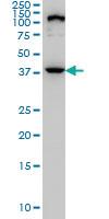 Anti-ELAC1 Mouse Monoclonal Antibody [clone: 1G2]