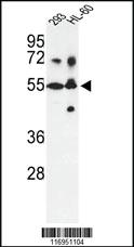 Anti-CYP21A2 Rabbit Polyclonal Antibody