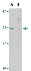 Anti-AKIRIN2 Rabbit Polyclonal Antibody