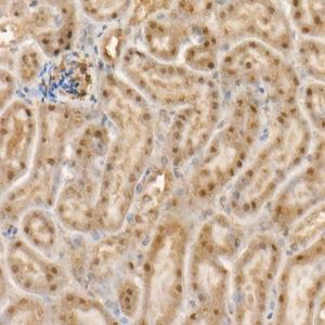 Immunohistochemistry analysis of paraffin-embedded mouse kidney using Anti-ABL1 Antibody [ARC55102] (A308851) at a dilution of 1:100(40x lens) Perform high pressure antigen retrieval with 10 mM citrate buffer pH 60 before commencing with IHC staining protocol