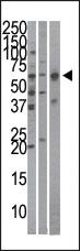 Anti-Importin alpha-4 (KPNA4) Rabbit Polyclonal Antibody