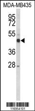 Anti-EGLN3 Rabbit Polyclonal Antibody