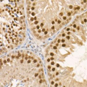 Immunohistochemistry analysis of paraffin-embedded rat testis using Anti-ABL1 Antibody [ARC55102] (A308851) at a dilution of 1:100(40x lens) Perform high pressure antigen retrieval with 10 mM citrate buffer pH 60 before commencing with IHC staining protocol