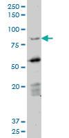 Anti-DAZ1 Mouse Monoclonal Antibody [clone: 3E3]