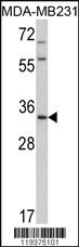 Anti-HPGD Rabbit Polyclonal Antibody