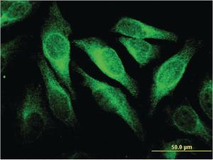 Anti-CEACAM6 Mouse Monoclonal Antibody [clone: 1G2]