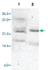 Anti-ANAPC10 Rabbit Polyclonal Antibody