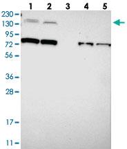 Anti-SORCS1 Rabbit Polyclonal Antibody