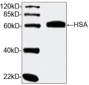 Anti-HSA Mouse Monoclonal Antibody [clone: 2C7B4]