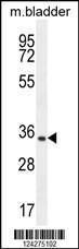 Anti-C15orf41 Rabbit Polyclonal Antibody (HRP (Horseradish Peroxidase))