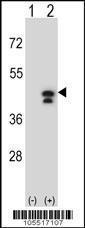 Anti-PGK1 Rabbit Polyclonal Antibody (PE (Phycoerythrin))