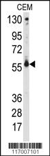 Anti-CYP2C9 Rabbit Polyclonal Antibody