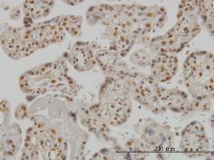 Anti-SMAD3 Mouse Monoclonal Antibody [clone: 7F3]