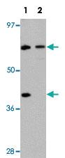 Anti-TCTN3 Rabbit Polyclonal Antibody