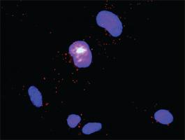 Anti-CD247 + DOCK2 Antibody Pair