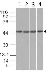 Anti-EMI1 antibody