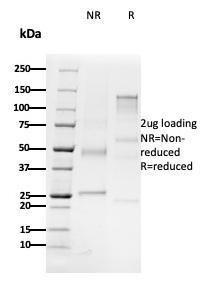 SDS-PAGE analysis of Anti-CD79b Antibody [B29/123] under non-reduced and reduced conditions; showing intact IgG and intact heavy and light chains, respectively. SDS-PAGE analysis confirms the integrity and purity of the antibody