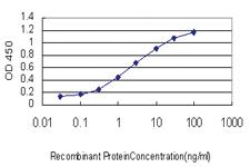 Anti-DAZ1 Mouse Monoclonal Antibody [clone: 3E3]