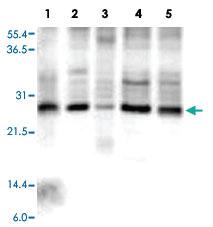 Anti-ANAPC10 Rabbit Polyclonal Antibody