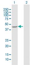 Anti-AADAT Rabbit Polyclonal Antibody