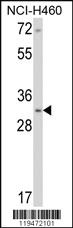 Anti-SRSF8 Rabbit Polyclonal Antibody