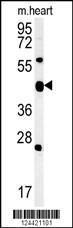 Anti-ACSF3 Rabbit Polyclonal Antibody (HRP (Horseradish Peroxidase))