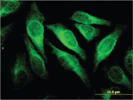 Anti-CEACAM6 Mouse Monoclonal Antibody [clone: 1G2]