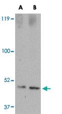 Anti-SPRED1 Rabbit Polyclonal Antibody