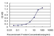 Anti-ELAC1 Mouse Monoclonal Antibody [clone: 1G2]