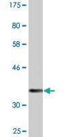 Anti-CK71 Mouse Monoclonal Antibody [clone: 1D4]