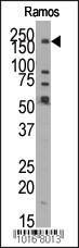 Anti-KDM3B Rabbit Polyclonal Antibody (FITC (Fluorescein))