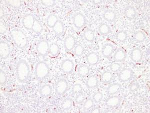 Immunohistochemical analysis of paraffin-embedded human Appendix using Anti-CD34 Antibody