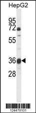 Anti-MARC1 Rabbit Polyclonal Antibody