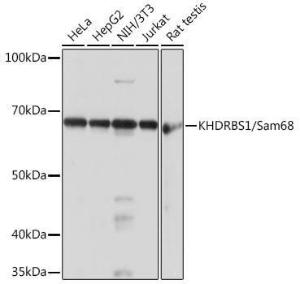 Western blot analysis of extracts of various cell lines, using Anti-SAM68 Antibody [ARC0858] (A307676) at 1:1,000 dilution The secondary antibody was Goat Anti-Rabbit IgG H&L Antibody (HRP) at 1:10,000 dilution Lysates/proteins were present at 25 µg per lane