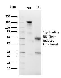 SDS-PAGE analysis of Anti-CD10 Antibody [MME/2590] under non-reduced and reduced conditions; showing intact IgG and intact heavy and light chains, respectively. SDS-PAGE analysis confirms the integrity and purity of the antibody.