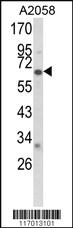 Anti-CYP2F1 Rabbit Polyclonal Antibody