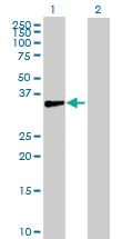 Anti-BRINP1 Mouse Polyclonal Antibody