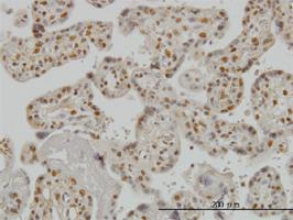 Anti-SMAD3 Mouse Monoclonal Antibody [clone: 7F3]